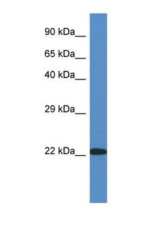 RPL14 / Ribosomal Protein L14 Antibody - RPL14 antibody Western blot of Fetal Kidney lysate. Antibody concentration 1 ug/ml.  This image was taken for the unconjugated form of this product. Other forms have not been tested.