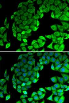 RPL14 / Ribosomal Protein L14 Antibody - Immunofluorescence analysis of MCF7 cells.