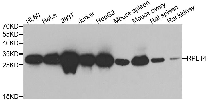 RPL14 / Ribosomal Protein L14 Antibody - Western blot analysis of extracts of various cell lines, using RPL14 antibody at 1:1000 dilution. The secondary antibody used was an HRP Goat Anti-Rabbit IgG (H+L) at 1:10000 dilution. Lysates were loaded 25ug per lane and 3% nonfat dry milk in TBST was used for blocking. An ECL Kit was used for detection and the exposure time was 10s.