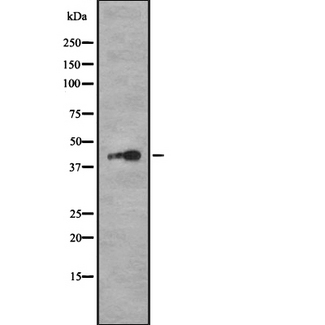 RPL14 / Ribosomal Protein L14 Antibody - Western blot analysis of RPL14 using MCF-7 whole cells lysates