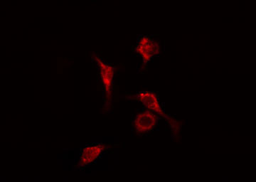 RPL14 / Ribosomal Protein L14 Antibody - Staining HeLa cells by IF/ICC. The samples were fixed with PFA and permeabilized in 0.1% Triton X-100, then blocked in 10% serum for 45 min at 25°C. The primary antibody was diluted at 1:200 and incubated with the sample for 1 hour at 37°C. An Alexa Fluor 594 conjugated goat anti-rabbit IgG (H+L) antibody, diluted at 1/600, was used as secondary antibody.