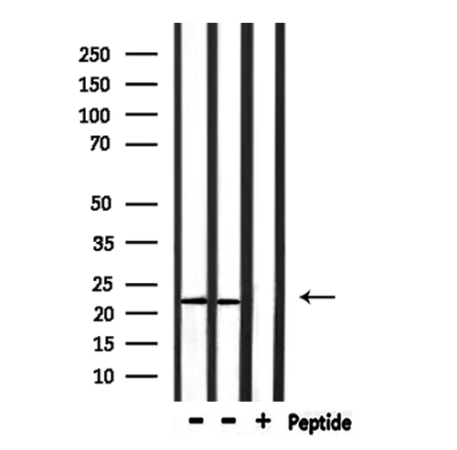 RPL14 / Ribosomal Protein L14 Antibody - Western blot analysis of extracts of rat brain and mouse spleen using RPL14 antibody.