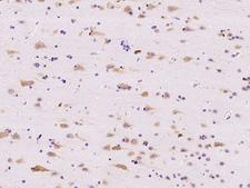 RPL14 / Ribosomal Protein L14 Antibody - Immunochemical staining of human RPL14 in human brain with rabbit polyclonal antibody at 1:500 dilution, formalin-fixed paraffin embedded sections.