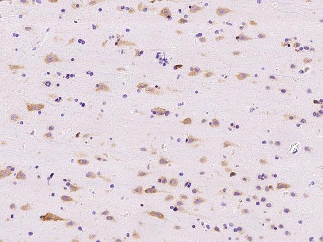 RPL14 / Ribosomal Protein L14 Antibody - Immunochemical staining of human RPL14 in human brain with rabbit polyclonal antibody at 1:500 dilution, formalin-fixed paraffin embedded sections.