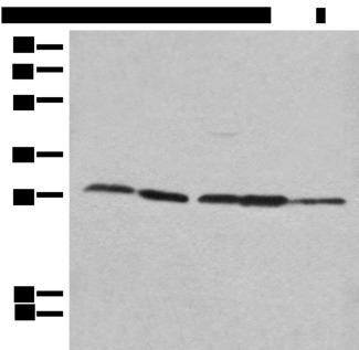 RPL14 / Ribosomal Protein L14 Antibody - Western blot analysis of 293T Hela 231 HEPG2 and A431 cell lysates  using RPL14 Polyclonal Antibody at dilution of 1:800