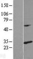 RPL14 / Ribosomal Protein L14 Protein - Western validation with an anti-DDK antibody * L: Control HEK293 lysate R: Over-expression lysate
