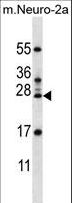 RPL15 / Ribosomal Protein L15 Antibody - RPL15 Antibody western blot of mouse Neuro-2a cell line lysates (35 ug/lane). The RPL15 antibody detected the RPL15 protein (arrow).