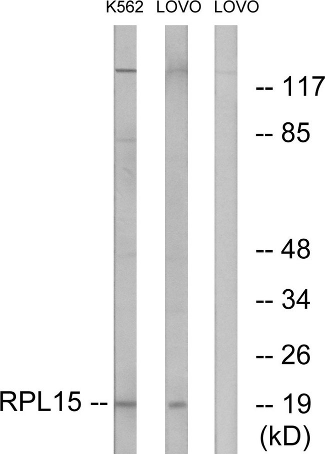 RPL15 / Ribosomal Protein L15 Antibody - Western blot analysis of lysates from LOVO and K562 cells, using RPL15 Antibody. The lane on the right is blocked with the synthesized peptide.