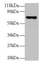 RPL15 / Ribosomal Protein L15 Antibody - Western blot All lanes: 60S ribosomal protein L15 antibody at 2µg/ml Lane 1: EC109 whole cell lysate Lane 2: 293T whole cell lysate Secondary Goat polyclonal to rabbit IgG at 1/15000 dilution Predicted band size: 25, 17 kDa Observed band size: 70 kDa