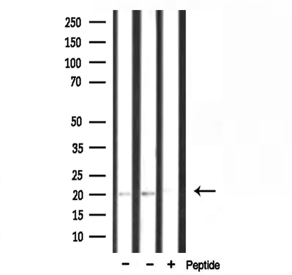 RPL15 / Ribosomal Protein L15 Antibody - Western blot analysis of extracts of various samples using RPL15 antibody