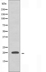 RPL15 / Ribosomal Protein L15 Antibody - Western blot analysis of extracts of K562 cells using RPL15 antibody.
