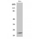 RPL17 / Ribosomal Protein L17 Antibody - Western blot of Ribosomal Protein L17 antibody