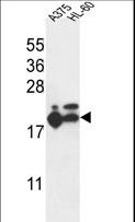 RPL17 / Ribosomal Protein L17 Antibody - RPL17 Antibody western blot of A375,HL-60 cell line lysates (35 ug/lane). The RPL17 antibody detected the RPL17 protein (arrow).