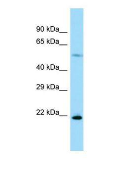 RPL17 / Ribosomal Protein L17 Antibody - Western blot of Rpl17 Antibody - C-terminal region in Rat Pancreas cells lysate.  This image was taken for the unconjugated form of this product. Other forms have not been tested.