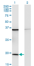 RPL17 / Ribosomal Protein L17 Antibody - Western Blot analysis of RPL17 expression in transfected 293T cell line by RPL17 monoclonal antibody (M01), clone 3G11.Lane 1: RPL17 transfected lysate(21.4 KDa).Lane 2: Non-transfected lysate.