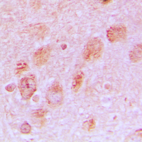 RPL17 / Ribosomal Protein L17 Antibody - Immunohistochemical analysis of RPL17 staining in human brain formalin fixed paraffin embedded tissue section. The section was pre-treated using heat mediated antigen retrieval with sodium citrate buffer (pH 6.0). The section was then incubated with the antibody at room temperature and detected using an HRP conjugated compact polymer system. DAB was used as the chromogen. The section was then counterstained with hematoxylin and mounted with DPX.