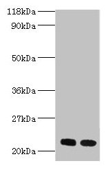 RPL17 / Ribosomal Protein L17 Antibody - Western blot All lanes: 60S ribosomal protein L17 antibody at 2µg/ml Lane 1: EC109 whole cell lysate Lane 2: 293T whole cell lysate Secondary Goat polyclonal to rabbit IgG at 1/15000 dilution Predicted band size: 22, 18, 27 kDa Observed band size: 22 kDa