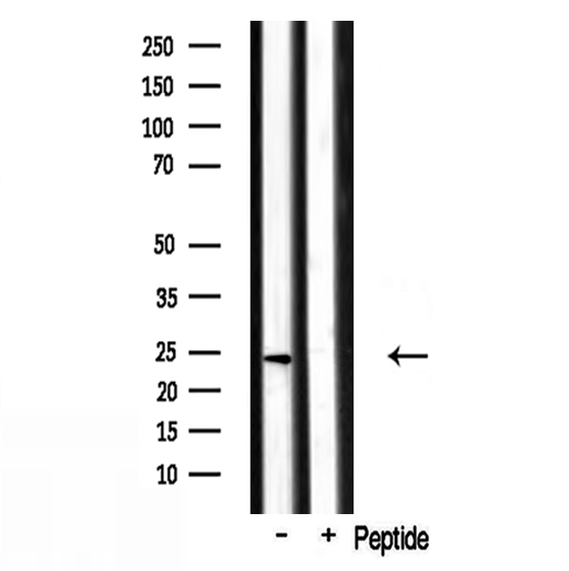RPL17 / Ribosomal Protein L17 Antibody - Western blot analysis of extracts of mouse liver tissue using RPL17 antibody.