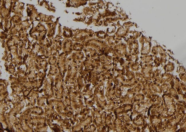 RPL17 / Ribosomal Protein L17 Antibody - 1:100 staining rat kidney tissue by IHC-P. The sample was formaldehyde fixed and a heat mediated antigen retrieval step in citrate buffer was performed. The sample was then blocked and incubated with the antibody for 1.5 hours at 22°C. An HRP conjugated goat anti-rabbit antibody was used as the secondary.