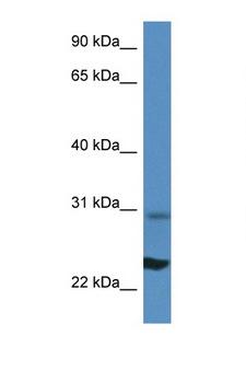 RPL17 / Ribosomal Protein L17 Antibody - RPL17 antibody Western blot of Mouse Liver lysate. Antibody concentration 1 ug/ml. This image was taken for the unconjugated form of this product. Other forms have not been tested.
