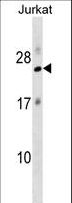RPL18 / Ribosomal Protein L18 Antibody - RPL18 Antibody western blot of Jurkat cell line lysates (35 ug/lane). The RPL18 antibody detected the RPL18 protein (arrow).