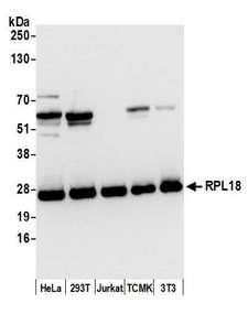 RPL18 / Ribosomal Protein L18 Antibody - Detection of human and mouse RPL18 by western blot. Samples: Whole cell lysate (15 µg) from HeLa, HEK293T, Jurkat, mouse TCMK-1, and mouse NIH 3T3 cells prepared using NETN lysis buffer. Antibody: Affinity purified rabbit anti-RPL18 antibody used for WB at 0.1 µg/ml. Detection: Chemiluminescence with an exposure time of 3 seconds.