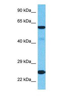 RPL18 / Ribosomal Protein L18 Antibody - Western blot of RPL18 Antibody with human HeLa Whole Cell lysate.  This image was taken for the unconjugated form of this product. Other forms have not been tested.