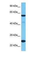 RPL18 / Ribosomal Protein L18 Antibody - Western blot of RPL18 Antibody with human HeLa Whole Cell lysate.  This image was taken for the unconjugated form of this product. Other forms have not been tested.