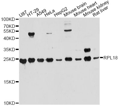 RPL18 / Ribosomal Protein L18 Antibody - Western blot analysis of extracts of various cell lines, using RPL18 antibody at 1:3000 dilution. The secondary antibody used was an HRP Goat Anti-Rabbit IgG (H+L) at 1:10000 dilution. Lysates were loaded 25ug per lane and 3% nonfat dry milk in TBST was used for blocking. An ECL Kit was used for detection and the exposure time was 60s.