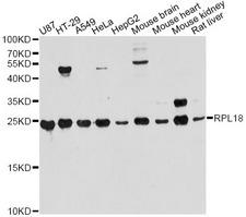 RPL18 / Ribosomal Protein L18 Antibody - Western blot analysis of extracts of various cell lines, using RPL18 antibody at 1:3000 dilution. The secondary antibody used was an HRP Goat Anti-Rabbit IgG (H+L) at 1:10000 dilution. Lysates were loaded 25ug per lane and 3% nonfat dry milk in TBST was used for blocking. An ECL Kit was used for detection and the exposure time was 60s.