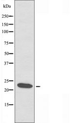 RPL18 / Ribosomal Protein L18 Antibody - Western blot analysis of extracts of COLO cells using RPL18 antibody.