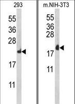 RPL18A Antibody - Western blot of RPL18A Antibody in HeLa, 293 cell line lysates (35 ug/lane). RPL18A (arrow) was detected using the purified antibody.