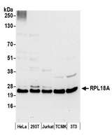 RPL18A Antibody - Detection of human and mouse RPL18A by western blot. Samples: Whole cell lysate (50 µg) from HeLa, HEK293T, Jurkat, mouse TCMK-1, and mouse NIH 3T3 cells prepared using NETN lysis buffer. Antibody: Affinity purified rabbit anti-RPL18A antibody used for WB at 0.1 µg/ml. Detection: Chemiluminescence with an exposure time of 30 seconds.