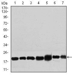 RPL18A Antibody - RPL18A Antibody in Western Blot (WB)