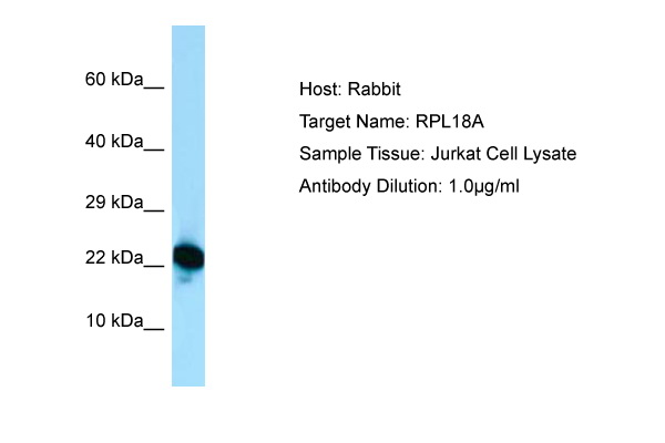 RPL18A Antibody -  This image was taken for the unconjugated form of this product. Other forms have not been tested.