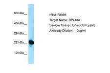 RPL18A Antibody -  This image was taken for the unconjugated form of this product. Other forms have not been tested.