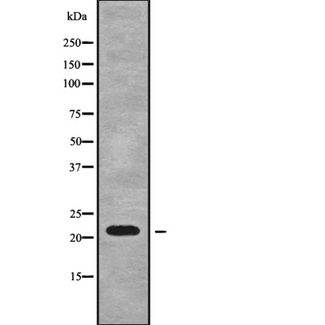 RPL18A Antibody - Western blot analysis of RPL18A using A549 whole cells lysates