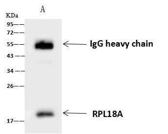 RPL18A Antibody - RPL18A was immunoprecipitated using: Lane A: 0.5 mg U-251MG Whole Cell Lysate. 4 uL anti-RPL18A rabbit polyclonal antibody and 60 ug of Immunomagnetic beads Protein A/G. Primary antibody: Anti-RPL18A rabbit polyclonal antibody, at 1:100 dilution. Secondary antibody: Goat Anti-Rabbit IgG (H+L)/HRP at 1/10000 dilution. Developed using the ECL technique. Performed under reducing conditions. Predicted band size: 21 kDa. Observed band size: 21 kDa.