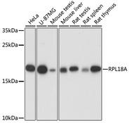 RPL18A Antibody - Western blot analysis of extracts of various cell lines using RPL18A Polyclonal Antibody at dilution of 1:1000.