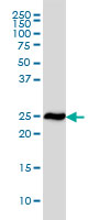 RPL19 / Ribosomal Protein L19 Antibody - RPL19 monoclonal antibody (M01), clone 3H4 Western blot of RPL19 expression in HeLa.
