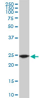 RPL19 / Ribosomal Protein L19 Antibody - RPL19 monoclonal antibody (M01), clone 3H4. Western blot of RPL19 expression in Raw 264.7.