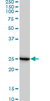 RPL19 / Ribosomal Protein L19 Antibody - RPL19 monoclonal antibody (M01), clone 3H4. Western blot of RPL19 expression in Jurkat.