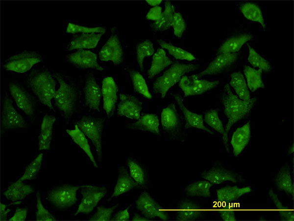 RPL19 / Ribosomal Protein L19 Antibody - Immunofluorescence of monoclonal antibody to RPL19 on HeLa cell (antibody concentration 10 ug/ml).