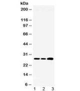 RPL19 / Ribosomal Protein L19 Antibody - Western blot testing of 1) rat liver, 2) mouse HEPA and 3) human HepG2 lysate with RPL19 antibody at 0.5ug/ml. Expected molecular weight: 23-28 kDa.
