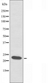 RPL19 / Ribosomal Protein L19 Antibody - Western blot analysis of extracts of JurKat cells using RPL19 antibody.