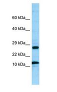 RPL21 / Ribosomal Protein L21 Antibody - RPL21 antibody Western Blot of MCF7.  This image was taken for the unconjugated form of this product. Other forms have not been tested.