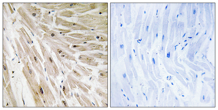 RPL22 / Ribosomal Protein L22 Antibody - Immunohistochemistry analysis of paraffin-embedded human heart tissue, using RPL22 Antibody. The picture on the right is blocked with the synthesized peptide.