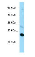 RPL22 / Ribosomal Protein L22 Antibody - RPL22 / L22 antibody Western Blot of Mouse Heart.  This image was taken for the unconjugated form of this product. Other forms have not been tested.