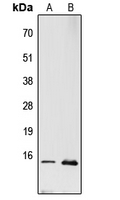 RPL22 / Ribosomal Protein L22 Antibody - Western blot analysis of RPL22 expression in PC12 (A); MCF7 (B) whole cell lysates.