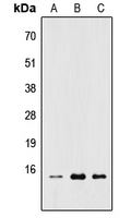 RPL22 / Ribosomal Protein L22 Antibody - Western blot analysis of RPL22 expression in HEK293T (A); Raw264.7 (B); H9C2 (C) whole cell lysates.